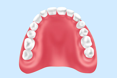 保険診療の入れ歯