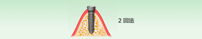 2回法